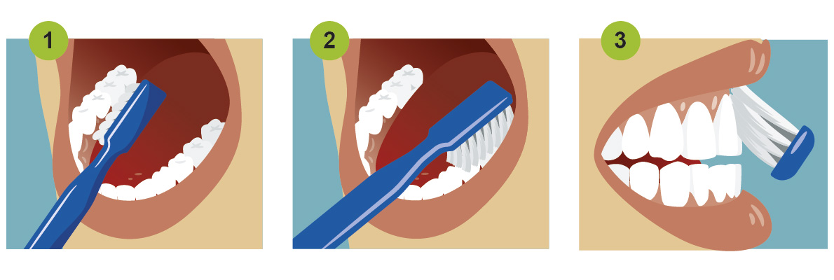 How to brush teeth illustration
